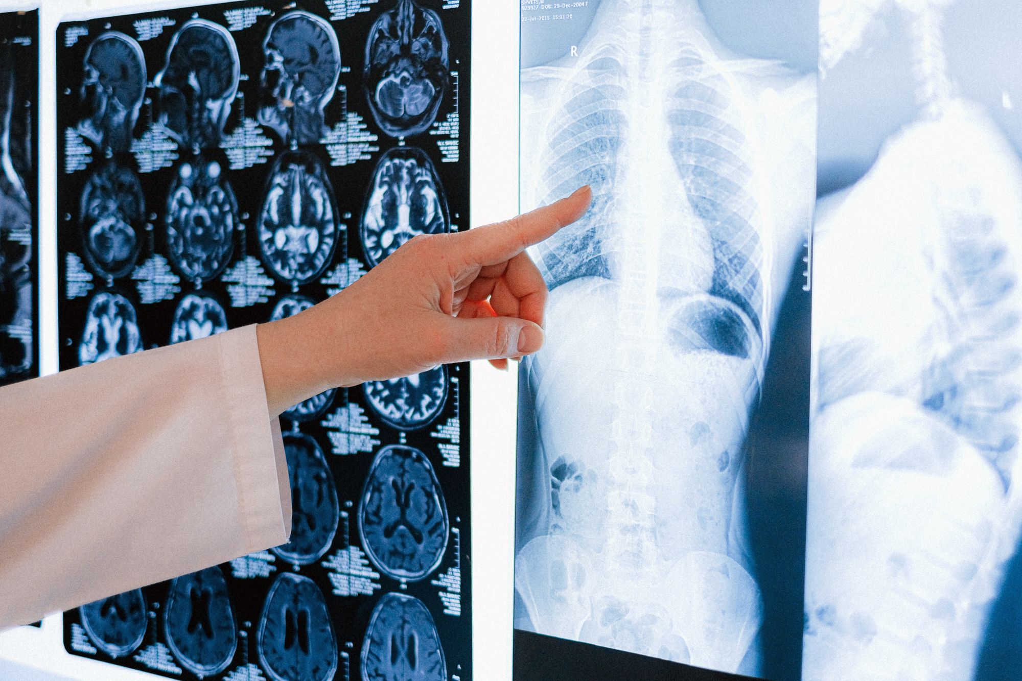 Teleradiologie: Was sie für Radiologinnen und Radiologen in Klinik und Praxis bedeutet